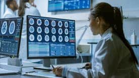 woman looking at brain scans